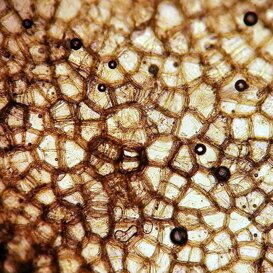 Cellule di buccia di patata