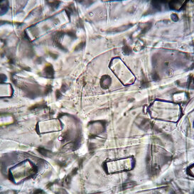 Stiloidi in cellule di aglio Stiloidi (cristalli di ossalato di calcio) in catafillo di aglio