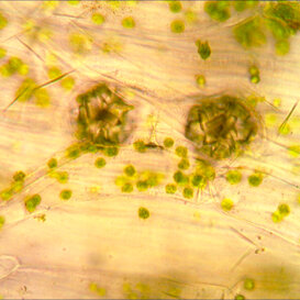 Druse di Dieffenbachia Druse (cristalli di ossalato di calcio) in foglia di Dieffenbachia