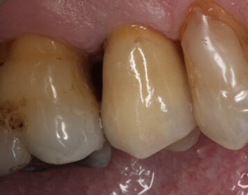 d114daf8-5827-4399-abc5-4eaed97706ea d114daf8-5827-4399-abc5-4eaed97706ea