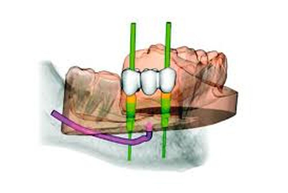 b32b3d35-e1a2-47f1-99fe-3b489afac1b7.jpeg b32b3d35-e1a2-47f1-99fe-3b489afac1b7.jpeg