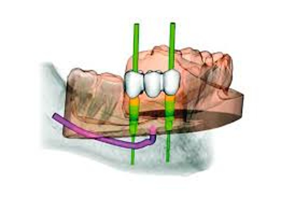 b32b3d35-e1a2-47f1-99fe-3b489afac1b7.jpeg b32b3d35-e1a2-47f1-99fe-3b489afac1b7.jpeg