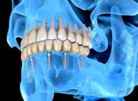 787686b4-bd15-4650-a0e8-07002c1d59ee