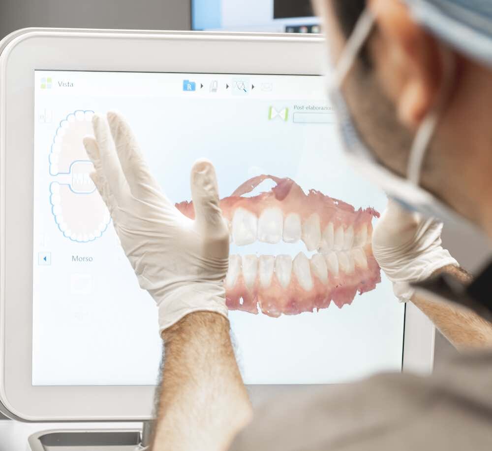 IMPRONTA DENTALE DIGITALE...NUOVA OPPORTUNITA'? IMPRONTA DENTALE DIGITALE...NUOVA OPPORTUNITA'?