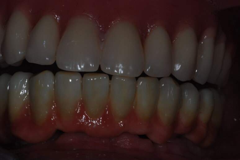 dsc_0013.jpeg dsc_0013.jpeg