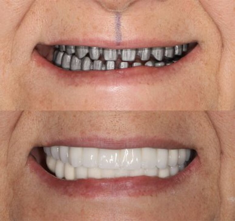 depositphotos_781509550-stock-photo-dental-dentistry-jaw-surgery-full.jpeg depositphotos_781509550-stock-photo-dental-dentistry-jaw-surgery-full.jpeg