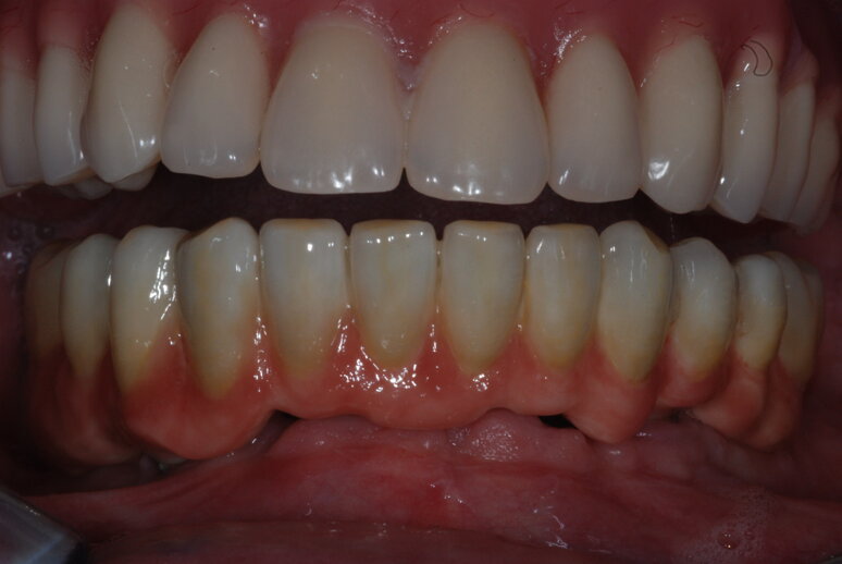 dsc_0015.jpeg dsc_0015.jpeg