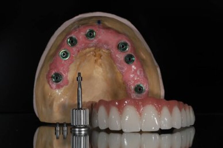 depositphotos_781506754-stock-photo-full-arch-dental-prosthesis-held.jpeg depositphotos_781506754-stock-photo-full-arch-dental-prosthesis-held.jpeg
