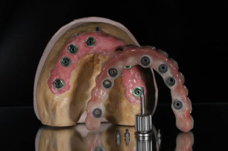 depositphotos_781506786-stock-photo-full-arch-dental-prosthesis-held.jpeg depositphotos_781506786-stock-photo-full-arch-dental-prosthesis-held.jpeg