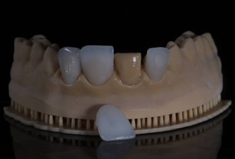 depositphotos_781500430-stock-photo-glass-ceramic-dental-porcelain-crowns.jpeg depositphotos_781500430-stock-photo-glass-ceramic-dental-porcelain-crowns.jpeg