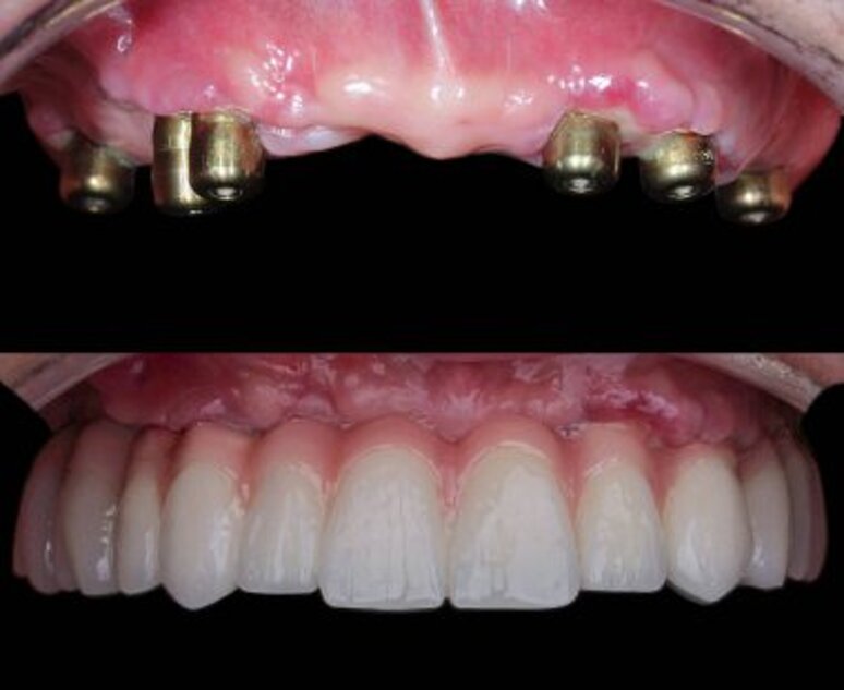 depositphotos_781504080-stock-photo-dental-dentistry-jaw-surgery-dental.jpeg depositphotos_781504080-stock-photo-dental-dentistry-jaw-surgery-dental.jpeg