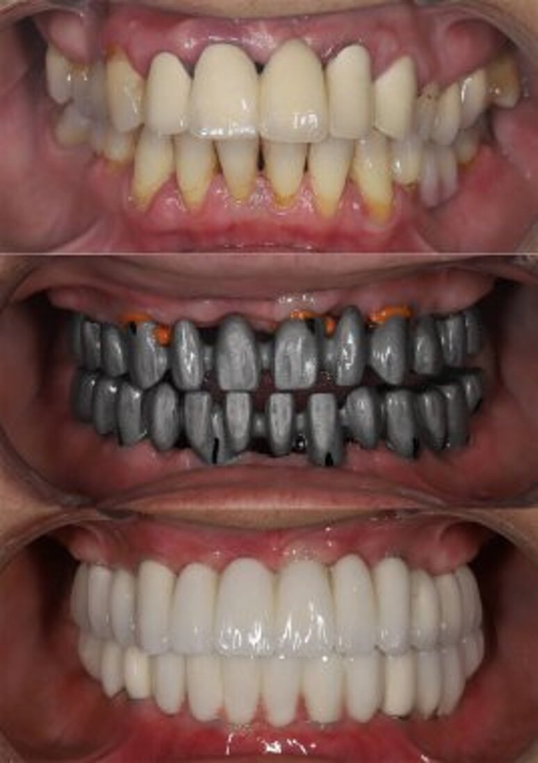 depositphotos_781509544-stock-photo-dental-dentistry-jaw-surgery-full.jpeg depositphotos_781509544-stock-photo-dental-dentistry-jaw-surgery-full.jpeg