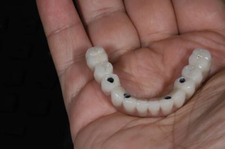 depositphotos_781508930-stock-photo-full-arch-dental-prosthesis-supported.jpeg depositphotos_781508930-stock-photo-full-arch-dental-prosthesis-supported.jpeg