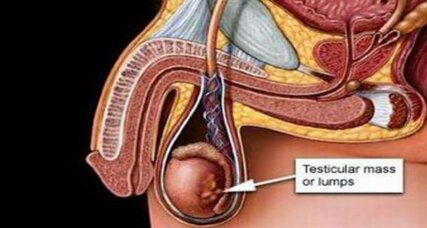 bd14ff48-7cab-487f-a1a8-18e6f87fea85