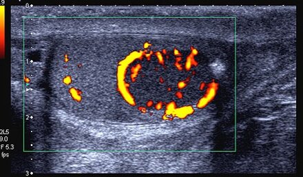 79fe4722-9128-4493-9e3a-e48c5b12bdd8