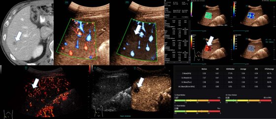 bb1f9f2d-19bb-455c-a1fc-93009336c67d