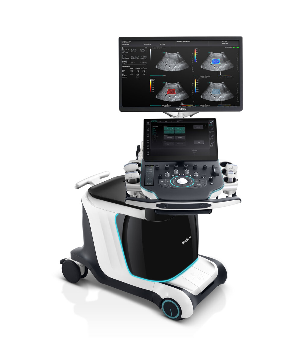 resona a20 mindray.jpeg