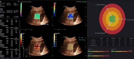 3cba4bbf-da32-4d79-911a-9f217433d12c