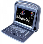 ecografo-chison-echo5