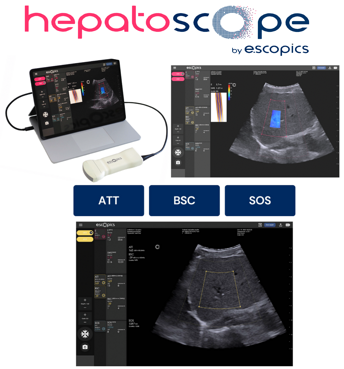 e062bf45-be86-4b99-a4ca-efedbafa7001 e062bf45-be86-4b99-a4ca-efedbafa7001