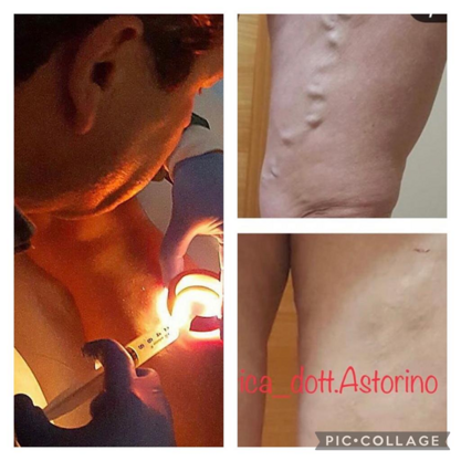 astorino 3 astorino 3