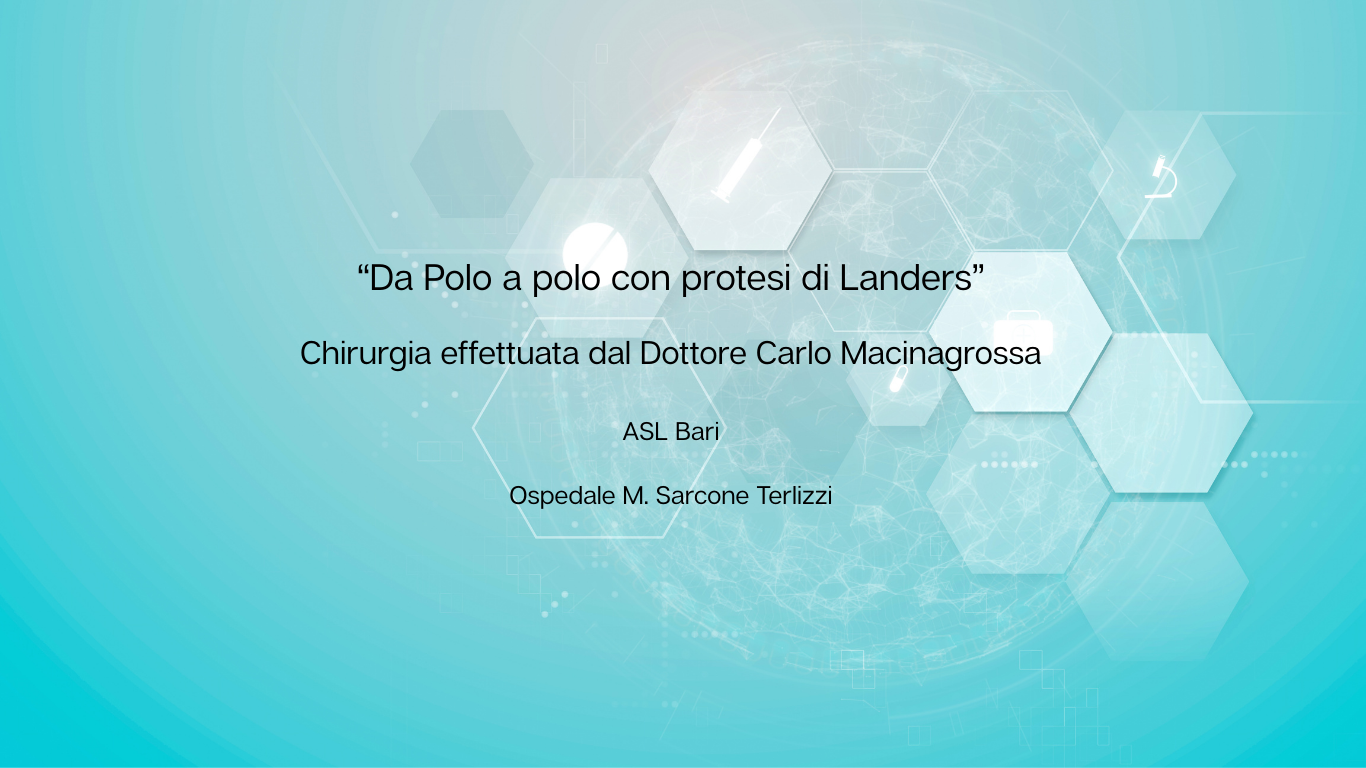Intervento di Chirurgia Oculare "Da Polo a Polo" Eseguito dal Dottor Giancarlo Macinagrossa