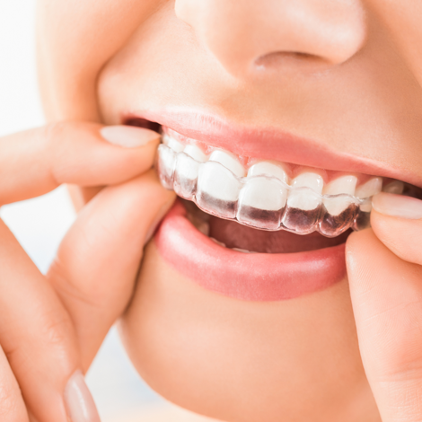 piezosurgery dentale