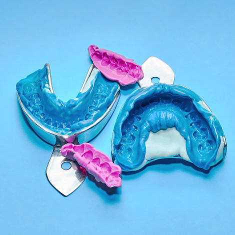 impronta dentale digitale