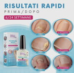 pics-nails-antimicotico-unghie-12ml-fingal-nail-treatment