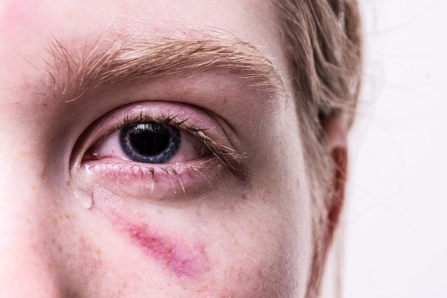 Violenza sugli operatori sanitari: un allarme inascoltato Violenza sugli operatori sanitari: un allarme inascoltato