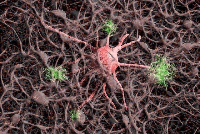 Nuova scoperta sull'Alzheimer.