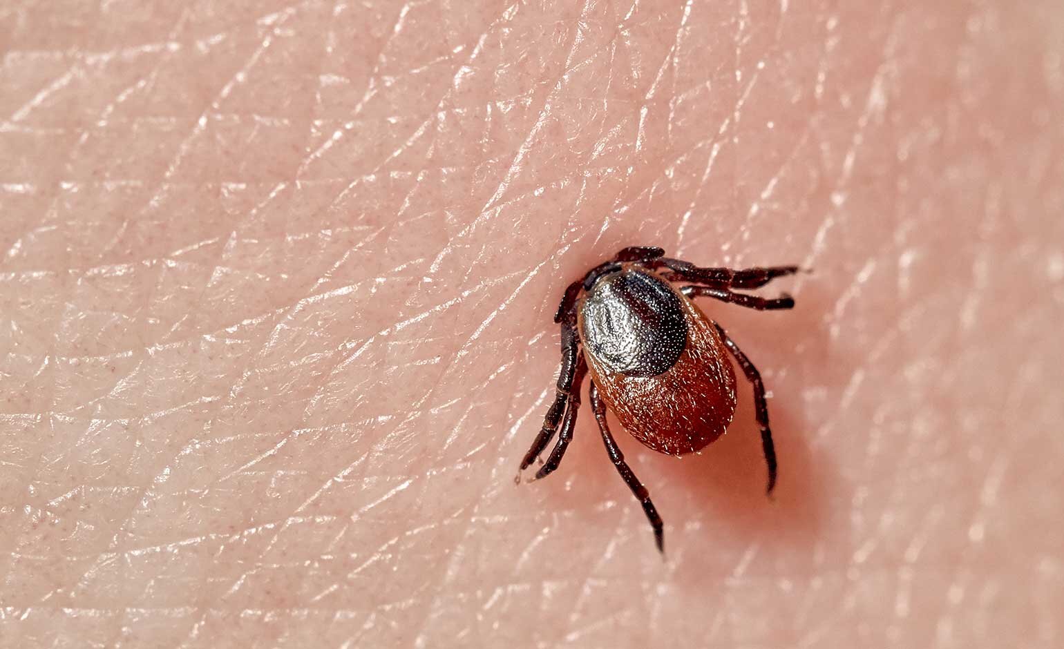 Sindrome alfa-gal: quando un morso di zecca rimodula il rapporto tra sistema immunitario e alimentazione