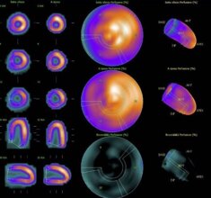 30633_ec2ae7813a2b6964aae81c831764a8de802ec3c5