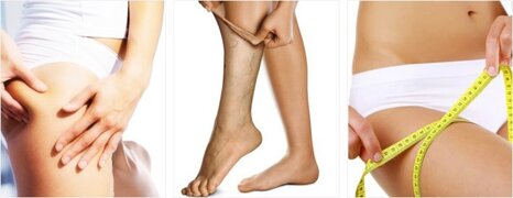 esteticagambe