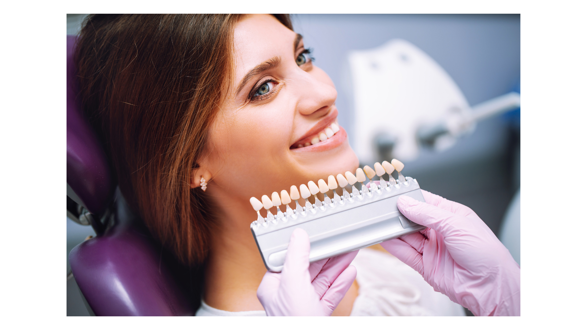 Paziente sorridente che mostra denti bianchi dopo uno sbiancamento dentale professionale