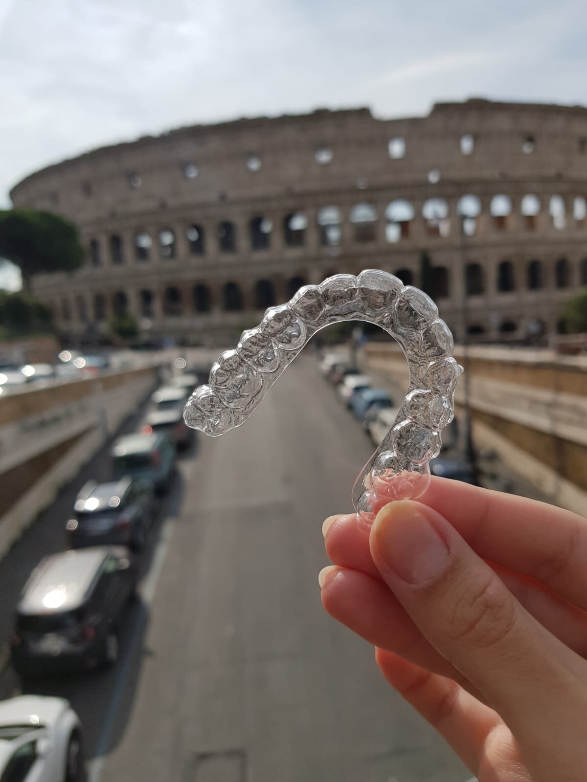 Allineatori Trasparenti Adulti: 33 Risposte ai tuoi Dubbi