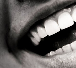 cura del sorriso