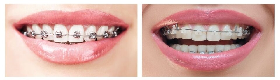 fa2d2078-811d-481b-9310-ef734aeeda46