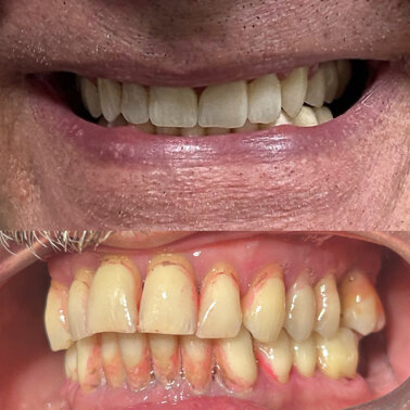 front post insta 2.001.jpeg