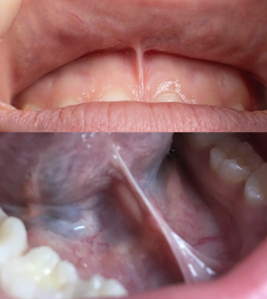 screenshot 2025-03-03 alle 16.16.01