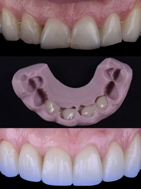 screenshot 2025-03-17 alle 10.04.00