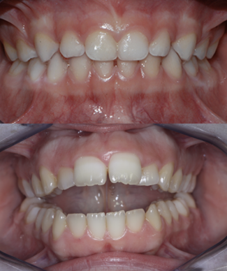 screenshot 2025-03-03 alle 15.51.45