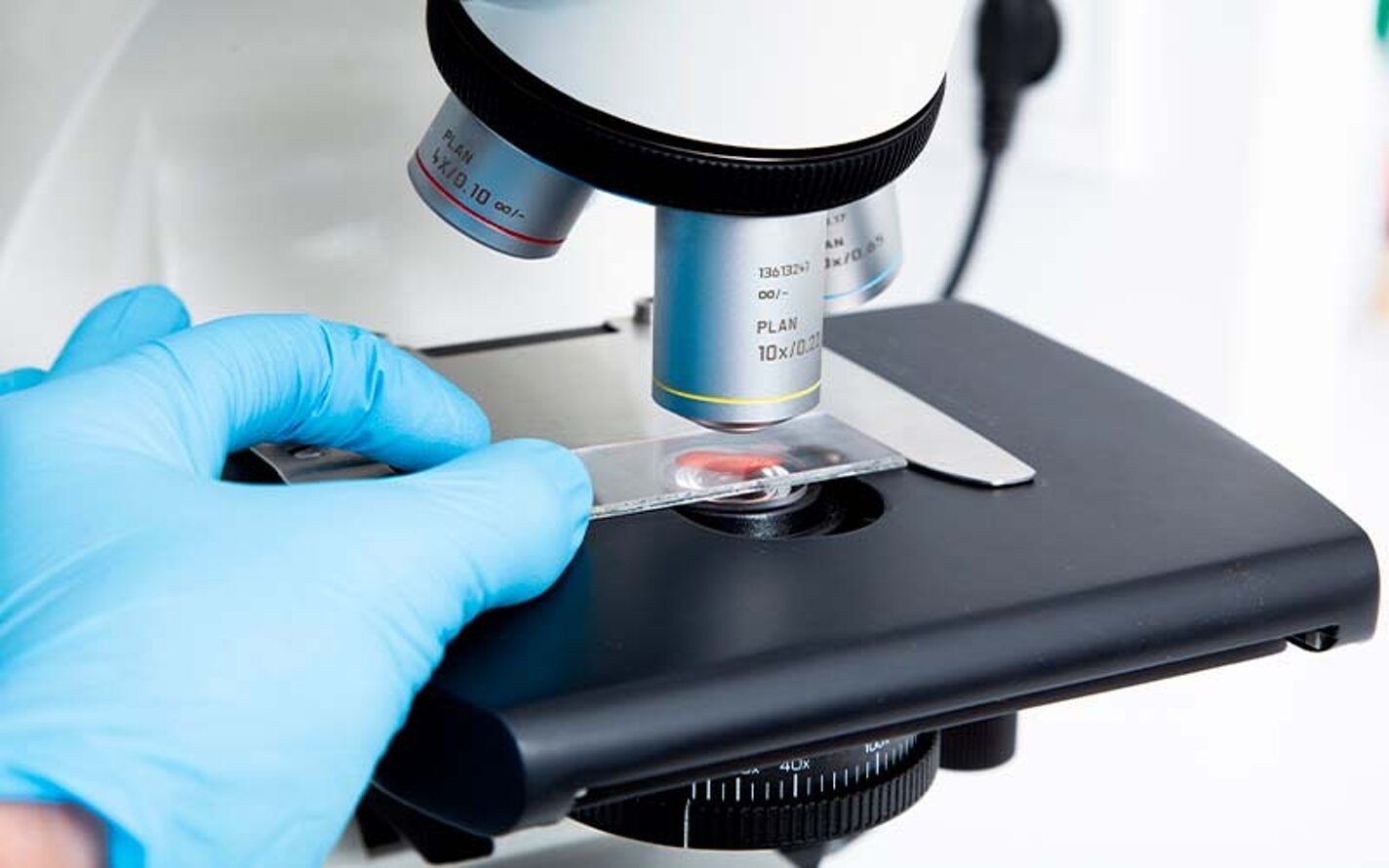 qual-è-la-differenza-tra-esame-istologico-e-citologico-.jpeg qual-è-la-differenza-tra-esame-istologico-e-citologico-.jpeg