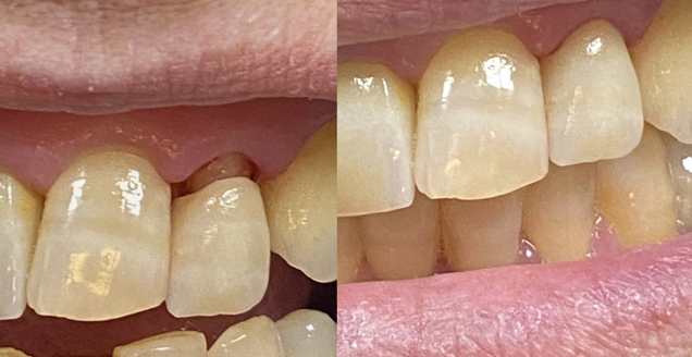 screenshot 2025-03-03 alle 14.13.44