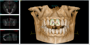 cbct_image_02