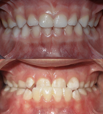 screenshot 2025-03-03 alle 15.39.23