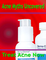 acne-myths-uncovered