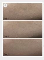 ocean-advance-perfection-siero-viso-rigenerante-con-acidi-aha-pha