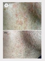 ocean-infinite-care-siero-viso-protettivo-e-idratante-quotidiano