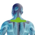 fit003-cervical-fit-therapy-box-with-8-patches